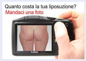 preventivo-liposuzione